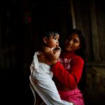 Read more about the article Scientists try to prove link between Amazon gold mining and disabilities in babies